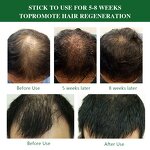 Ginger Hair Growth Serum - Manufacturer - Private Label Natural Organic Anti-Loss Regrowth Scalp Care