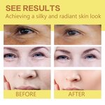 Turmeric Face Oil - Manufacturer - Private Label Anti Acne Lightening Dark Spot Corrector Brightening