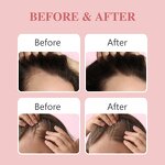 Rosemary Hair Oil - Manufacturer - Private Label Anti Loss Regrowth Hair Growth Treatments Serum