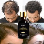 Biotin Caffeine Hair Oil - Manufacturer - Private Label Anti-Loss Regrowth Repair Treatment Serum