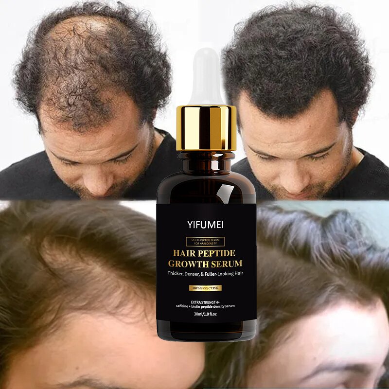 Biotin Caffeine Hair Oil - Manufacturer - Private Label Anti-Loss Regrowth Repair Treatment Serum