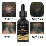Biotin Hair Growth Serum - Manufacturer - Private Label 100% Effective Anti Loss Repair Regrowth