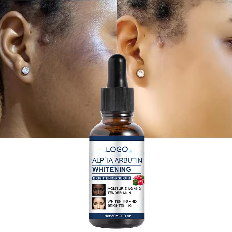 Alpha Arbutin Serum - Manufacturer - Private Label Niacinamide Whitening Dark Spot Anti Wrinkle