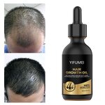 Biotin Hair Growth Serum - Manufacturer - Private Label 100% Effective Anti Loss Repair Regrowth