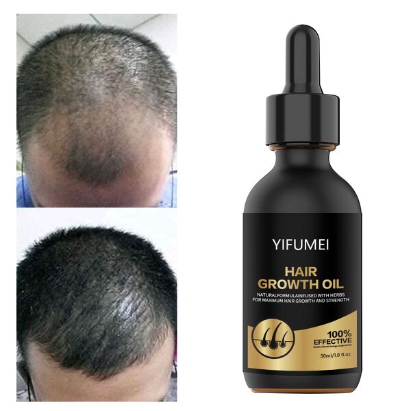 Biotin Hair Growth Serum - Manufacturer - Private Label 100% Effective Anti Loss Repair Regrowth