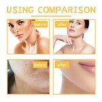 Turmeric Body Scrub - Manufacturer - Organic Dead Sea Salt Peeling Acne Cleansing Whitening Brightening