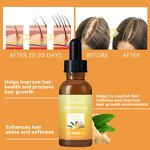 Ginger Hair Growth Oil - Manufacturer - Natural Revitalizing Scalp Massage Anti Hair Loss Repair