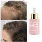 Rosemary Hair Oil - Manufacturer - Private Label Anti Loss Regrowth Hair Growth Treatments Serum