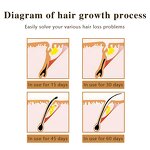 Ginseng Hair Growth Oil - Manufacturer - Private Label Natural Organic Anti-Loss Regrowth Serum