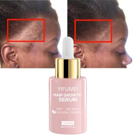 Rosemary Hair Growth Serum - Manufacturer - Private Label Organic Anti Loss Regrowth Repair Oil