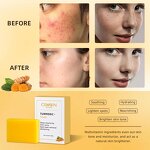 Turmeric Soap - Manufacturer - Wholesale Organic Handmade Deep Cleansing Anti Acne Lightening