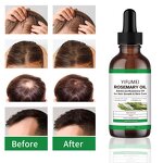 Rosemary Hair Oil - Manufacturer - Private Label Wholesale Anti-Loss Regrowth Treatment Repair Serum