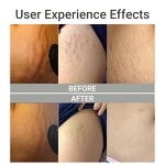 Stretch Mark Cream Manufacturer - Private Label for Pregnancy Anti Mark