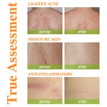 Body Lotion Manufacturer - Natural Dry Skin with Glycerin Turmeric Whitening