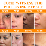 Skin Care Set Manufacturer - Private Label Organic Papaya Whitening Fast Bleaching