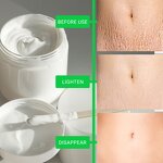 Stretch Mark Cream Manufacturer - Private Label for Pregnancy Anti Mark