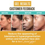 Cosmetic Set Manufacturer - High Class Whitening with Turmeric Soap, Serum & Lotion