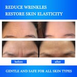 Wrinkle Remover Patches - Manufacturer - OEM Custom Logo Collagen Forehead Instant Strips