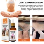 Dark Knuckle Serum - Manufacturer - OEM ODM Factory 7 Days Fast Whitening Spot Remover