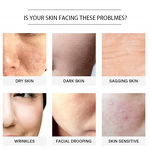 Coffee Body Scrub - Manufacturer - Natural Organic Coconut Shea Butter Acne Stretch Marks