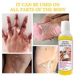 Peeling Oil - Manufacturer - Extra Strong Lighten Elbows Knees Melanin Dark Skin Bleaching