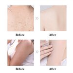 Watermelon Body Scrub - Manufacturer - Women's Pink Vitamin C Exfoliating Nourishing Skincare