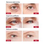Eye Cream - Manufacturer - Private Label Anti Dark Circles Remove Wrinkle Whitening Products