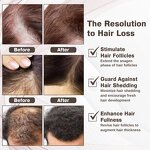 Hair Growth Serum - Manufacturer - Private Label 5% 10% Ghk-Cu Ahk-Cu Peptide Treatment