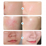 Vitamin C Facial Mask - Manufacturer - Deep Moisturizing Beauty Whitening Skin Care Mask