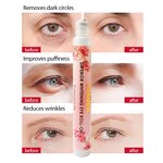 Retinol Eye Serum - Manufacturer - OEM ODM Instant Wrinkle Remover Anti Dark Circle Care
