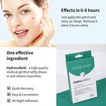 Acne Pimple Patch - Manufacturer - Private Label 180Pcs Cute Star Hydrocolloid for Face