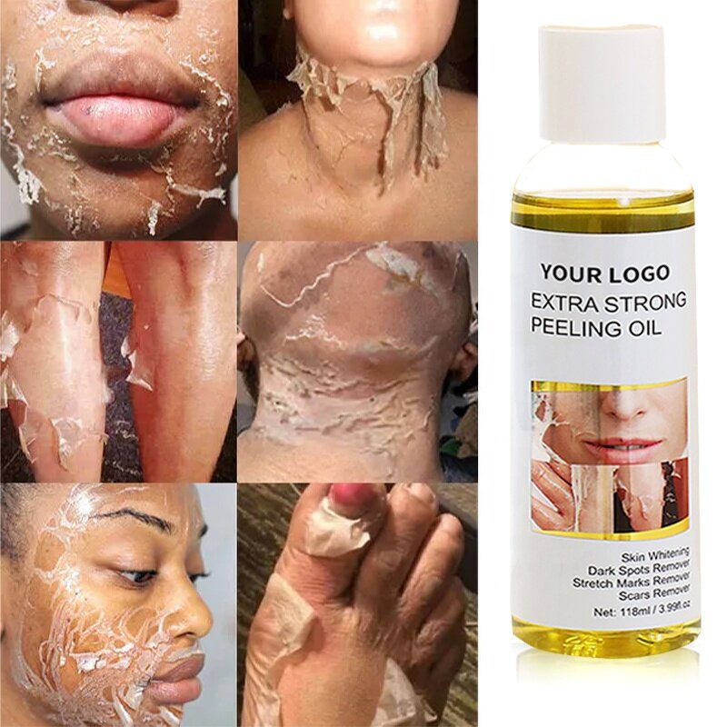 Orange Peeling Lotion - Manufacturer - Extra Strength Organic Black Skin Whitening Peeling Oil