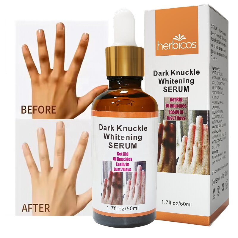 Yellow Peeling Oil - Manufacturer - OEM Super Strength Face Body Knees Hands Melanin Bleaching