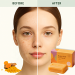 Organic Soap Bar - Manufacturer - Private Label Vitamin C Turmeric Kojic Acid Dark Spots