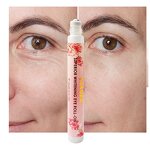 Eye Serum Roller - Manufacturer - Private Label Anti Dark Circles Hyaluronic Acid Eye Care