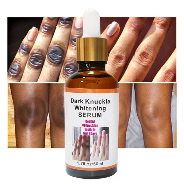 Hand Whitening Serum - Manufacturer - Private Label Skin Products Dark Knuckle Lightening Care