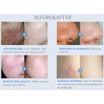 沙龙级水氧仪供应商-美规插头 hydrodermabrasion