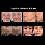 RF真空 cavitation 仪工厂-身体轮廓瘦身