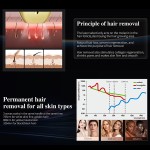 CE认证二极管激光仪工厂-三波3D冰点