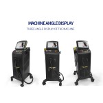 医用二极管激光脱毛仪工厂-755 808 1064纳米新款