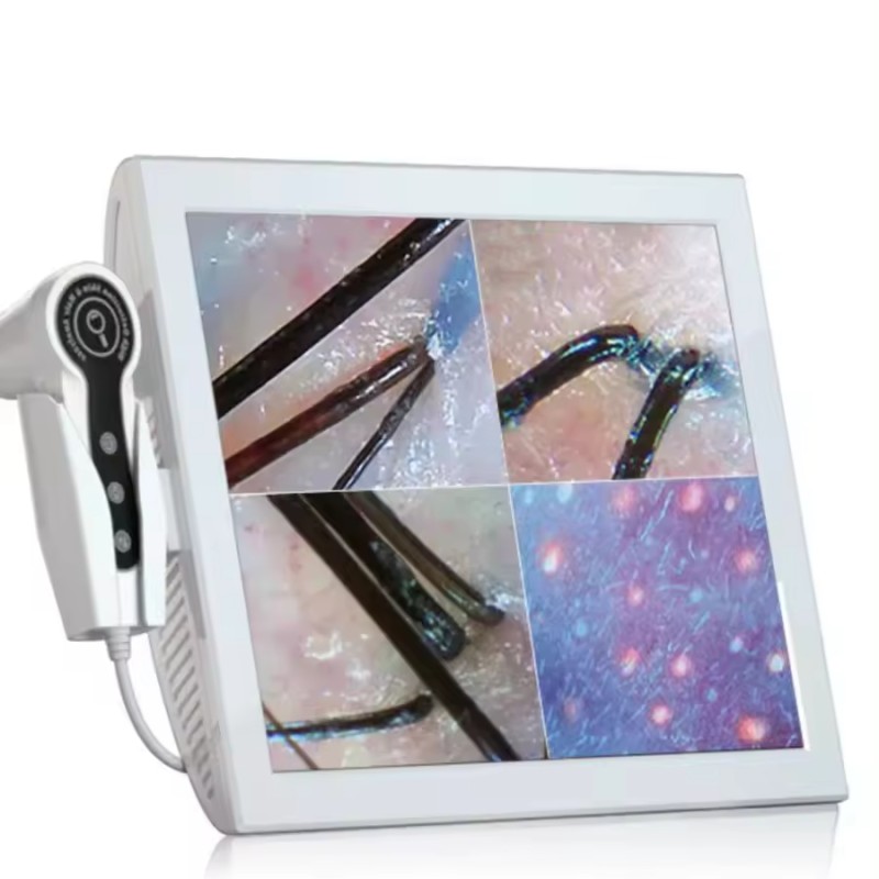 Skin Tightening Machine Supplier - OEM Facial Lifting Anti-wrinkle Rejuvenation