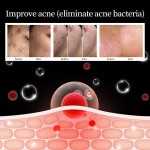 无创皮肤助推器供应商-OEM ACIACIA补水抗衰仪器