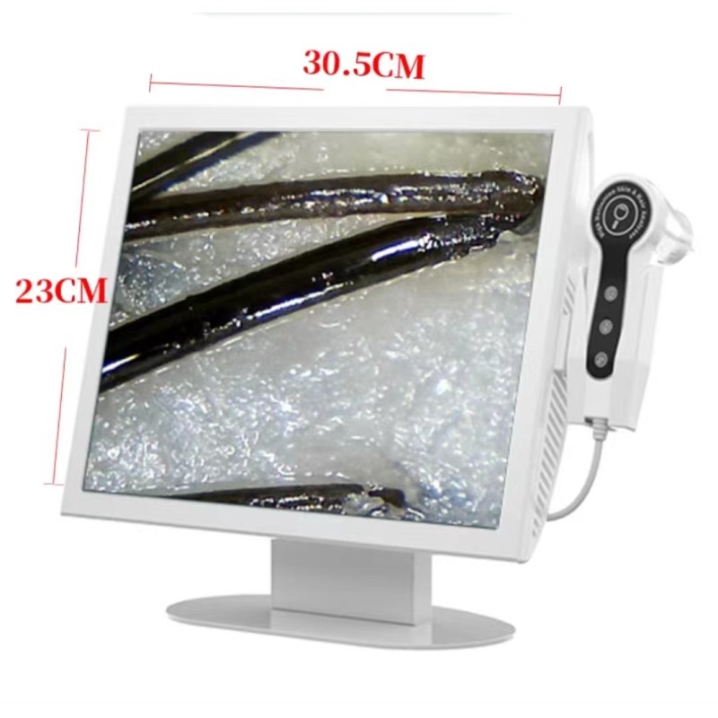 Digital HD Detector Factory - OEM 15-inch Hair Skin Analyzer Problem Detection