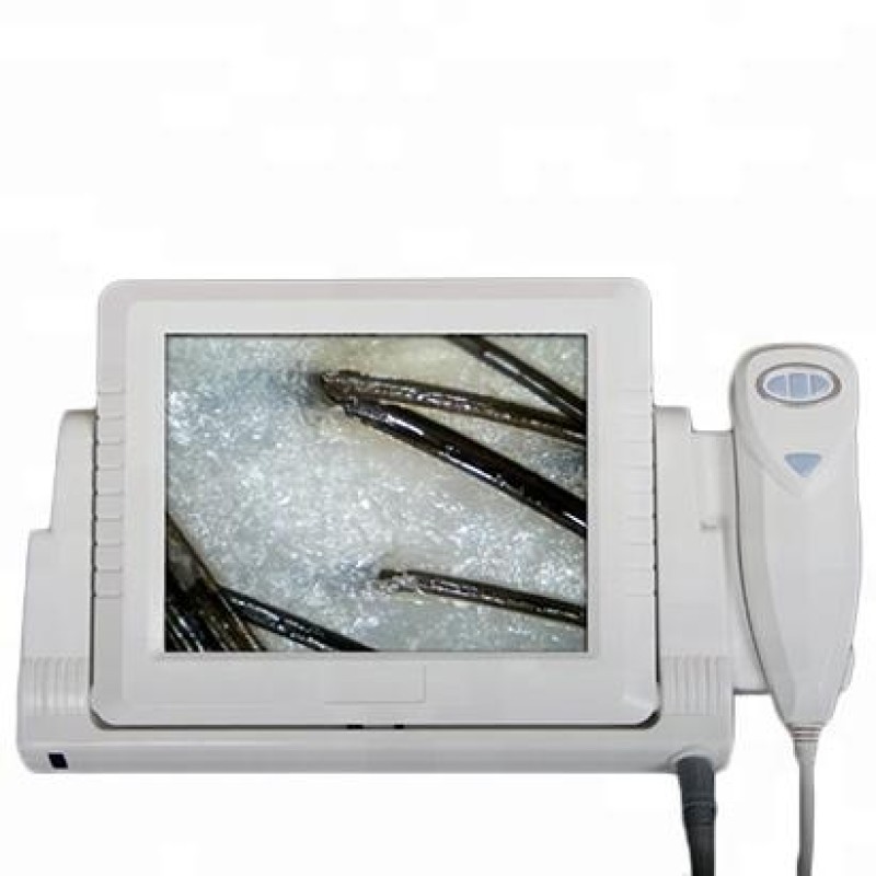 Scalp Treatment Machine Factory - OEM Portable Big Screen Hair Analyzer Equipment