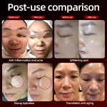 无针美塑仪生产商-OEM ACIACIA皮肤助推器水合