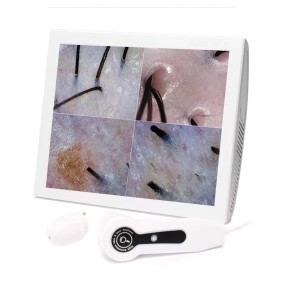 Scalp Analyzer Manufacturer - OEM Portable Skin Hair Analysis EU IT US Plugs