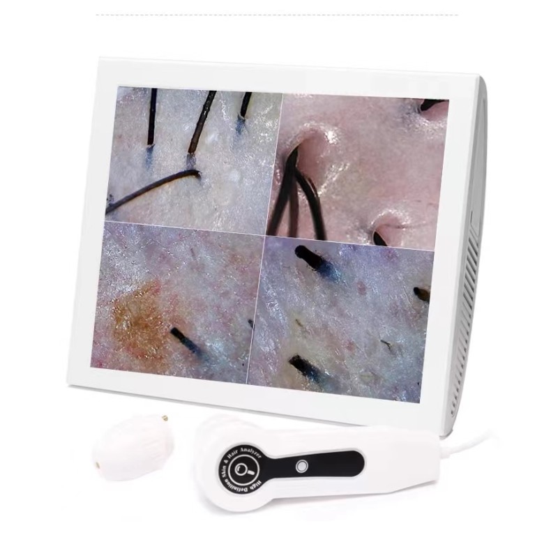 Scalp Analyzer Manufacturer - OEM Portable Skin Hair Analysis EU IT US Plugs