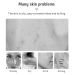 Anti Acne Soap Supplier - OEM Customize Logo Vitamin C Turmeric Soap