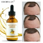 防脱发油工厂-OEM天然快速生发精华油
