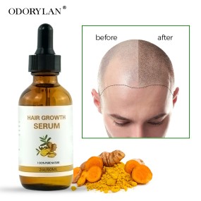 Anti Hair Loss Oil Factory - OEM Natural Fast Hair Growth Serum Oil
